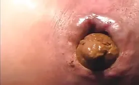 Very closeup shitting