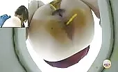 She refused to wipe her ass